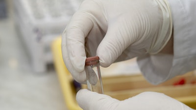Labtesting Largest112315