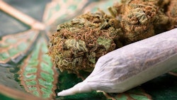 Joint