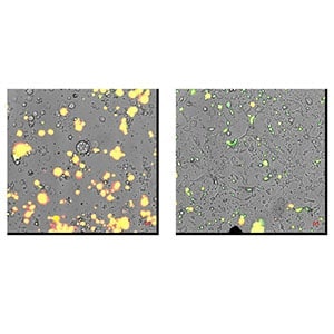 Gi Cancer Apoptosis