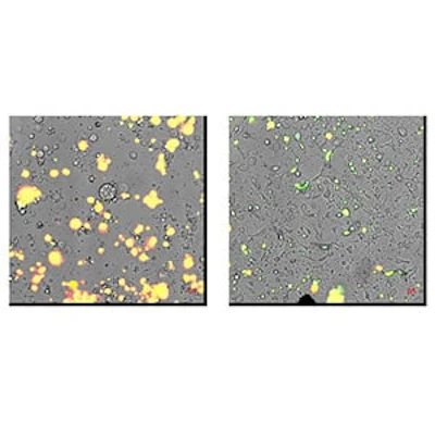 Gi Cancer Apoptosis