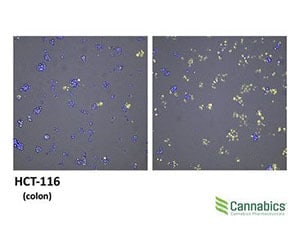 Cannabics Colon Cancer Cbn