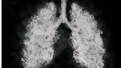 I Stock 1179207088 E Fmt