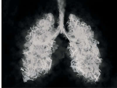 I Stock 1179207088 E Fmt