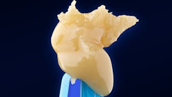 Blue River Flan is a designer solventless “super concentrate” made from mechanically “deconstructing” live hash rosin using only advanced mechanical separation techniques known as Blue River AMST.